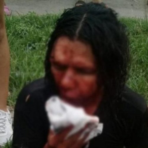 Homofóbia:  en Tucumán golpearon con un ladrillo a un hombre por ser gay