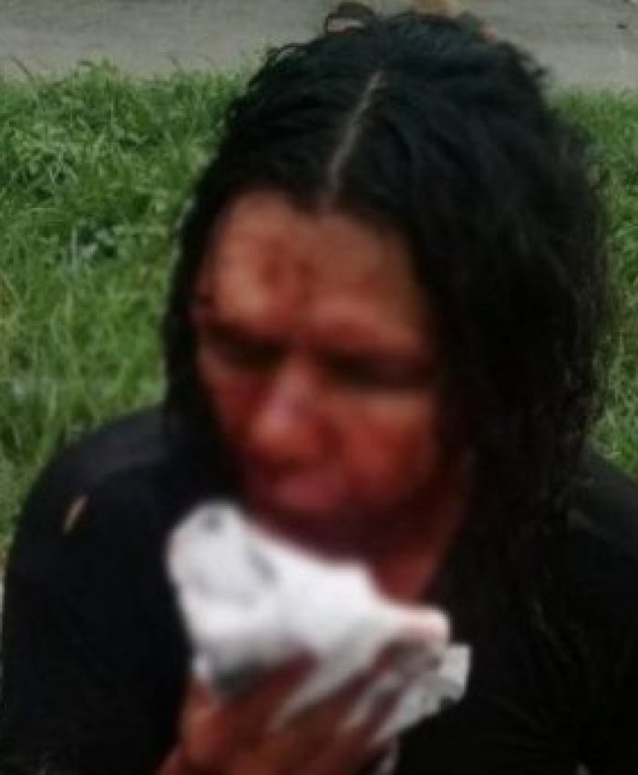 Homofóbia:  en Tucumán golpearon con un ladrillo a un hombre por ser gay