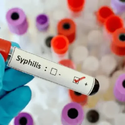 Alarmante suba de los casos de sífilis: en el ultimo año se incrementaron un 71%