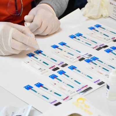 Salud informa los lugares donde realizan testeos gratuitos de Hepatitis