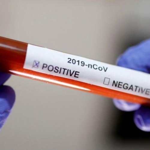 Covid-19: Salud Pública realiza testeos en l peatonal