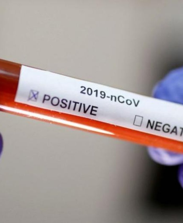 Covid-19: Salud Pública realiza testeos en l peatonal