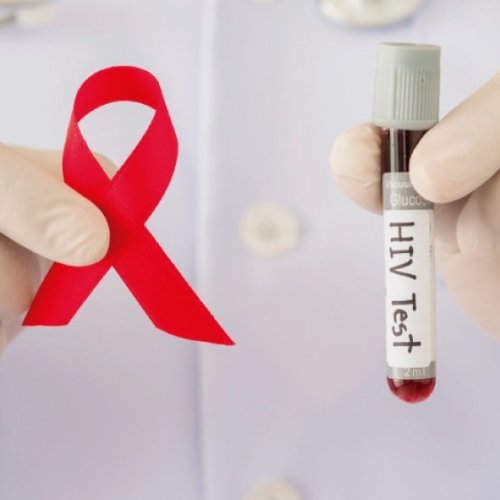 Se realizará una campaña de testeo de VIH