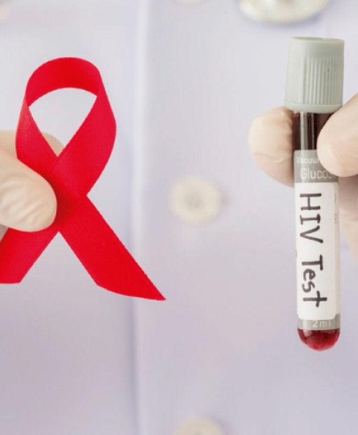 Se realizará una campaña de testeo de VIH