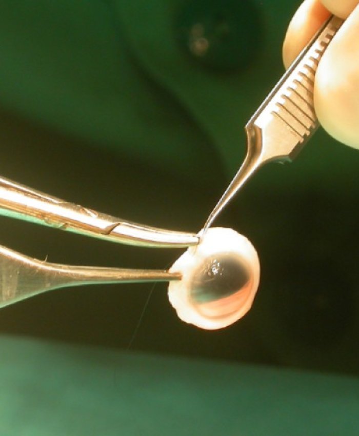 El Hospital Marcial Quiroga duplicó las donaciones para trasplante de tejidos