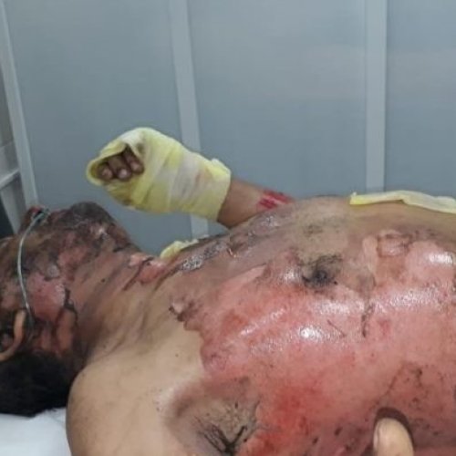 Cincos siglos igual: quemaron y balearon a un campesino durante un desalojo de tierras