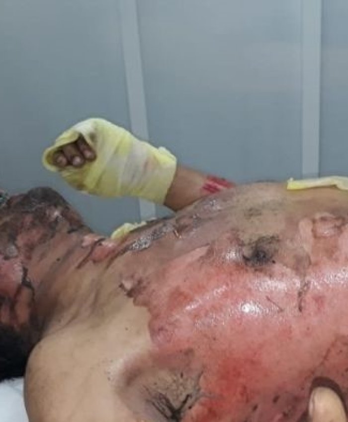 Cincos siglos igual: quemaron y balearon a un campesino durante un desalojo de tierras