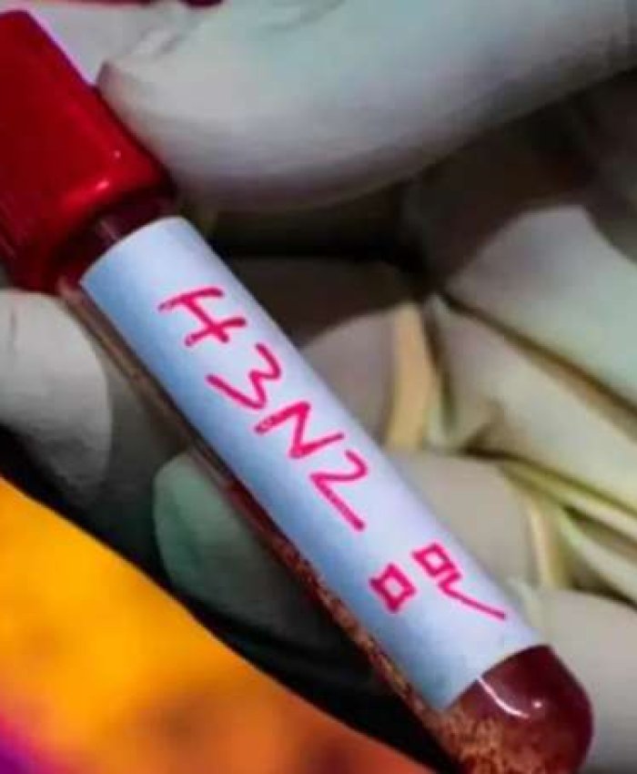 Confirmaron la primera muerte por super gripe H3N2 en la Argentina y crecen los contagios